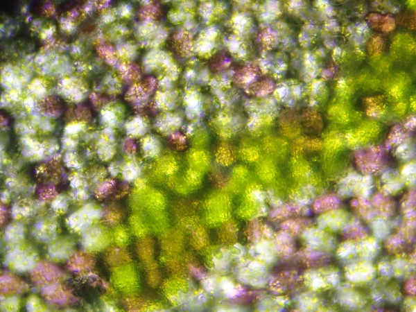Coelochaete under microscope
